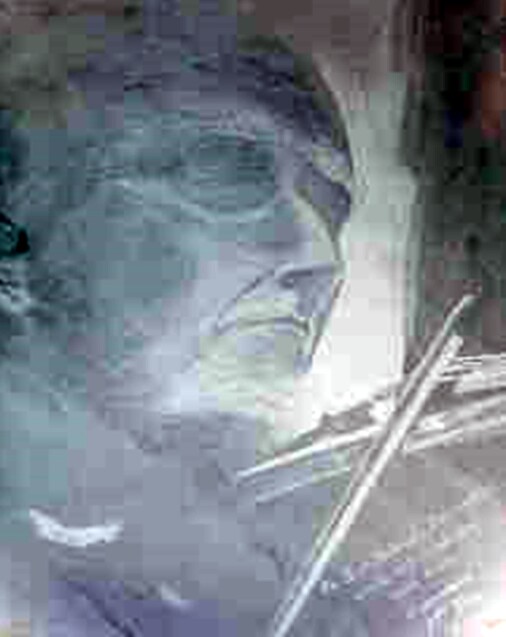 Sir Yehudi Menunhin | Dr. Angel Escudero Juan